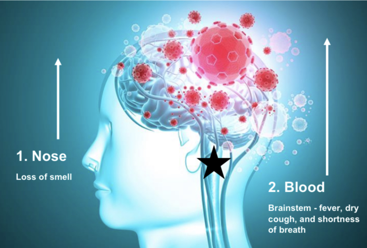 clinical presentation of covid 19 in dementia patients